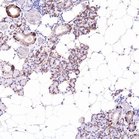 File:CK5-6.parotid.1.jpg