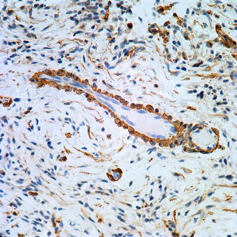 File:SMA.pericytes.400x.jpg