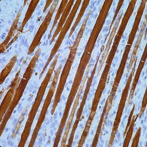 File:Desmin.skeletal muscle striations.400x.jpg