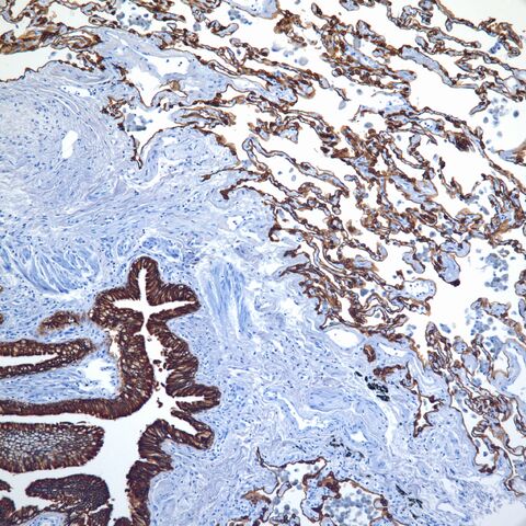 File:AE1 3.lung.jpg