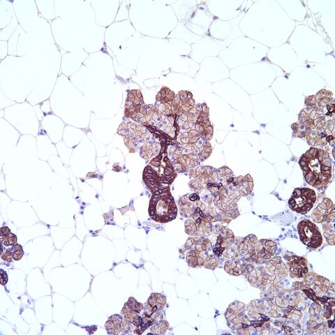 File:AE1 3.parotid.1.jpg