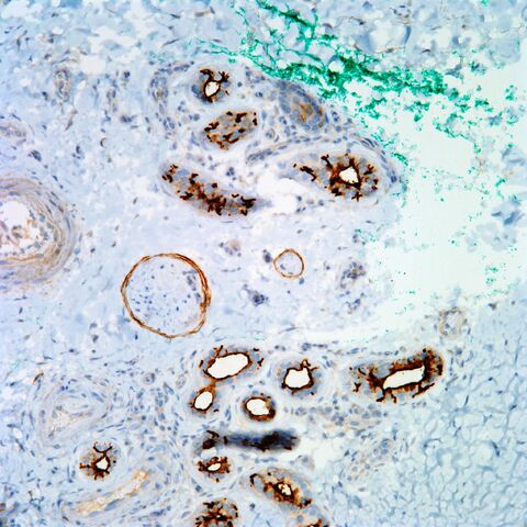 File:EMA.eccrine.perineurium.jpg