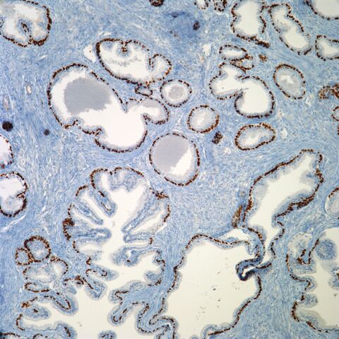 File:P63.benign prostate.jpg