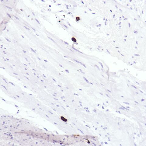 File:Tryptase.mast cell.1.jpg
