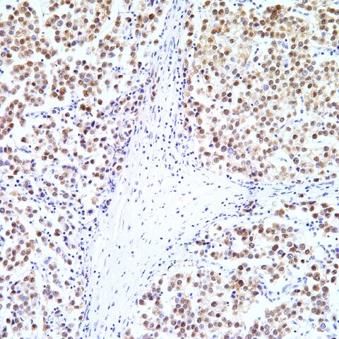 File:OCT.3-4.seminoma.1.jpg