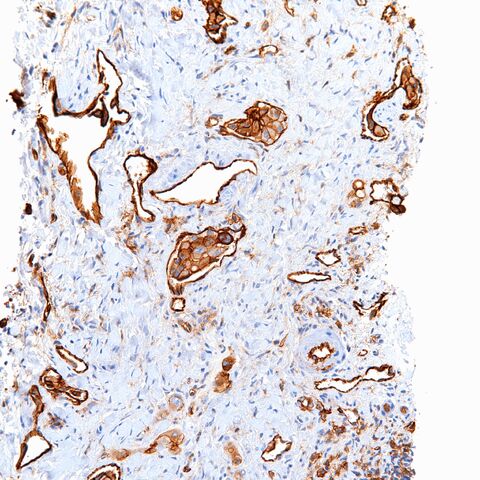 File:CD31.EHE.6.jpg