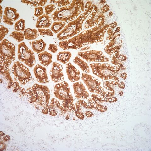 File:MOC-31.small intestine.jpg