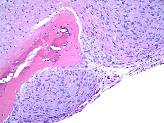 File:OFMT8.jpg