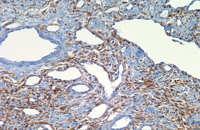 File:Bcl-2.SFT.1.jpg