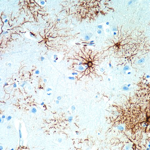 File:GFAP.normal cortex.400x.2.jpg