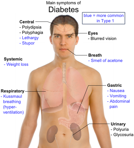 檔案:Main symptoms of diabetes.png