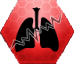 Stn Pulmonary Fibrosis
