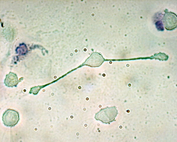 File:Macrophage.jpg