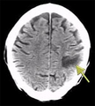 Thumbnail for version as of 16:46, October 5, 2006