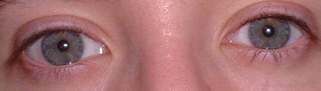 File:Greyeyesexample.jpg