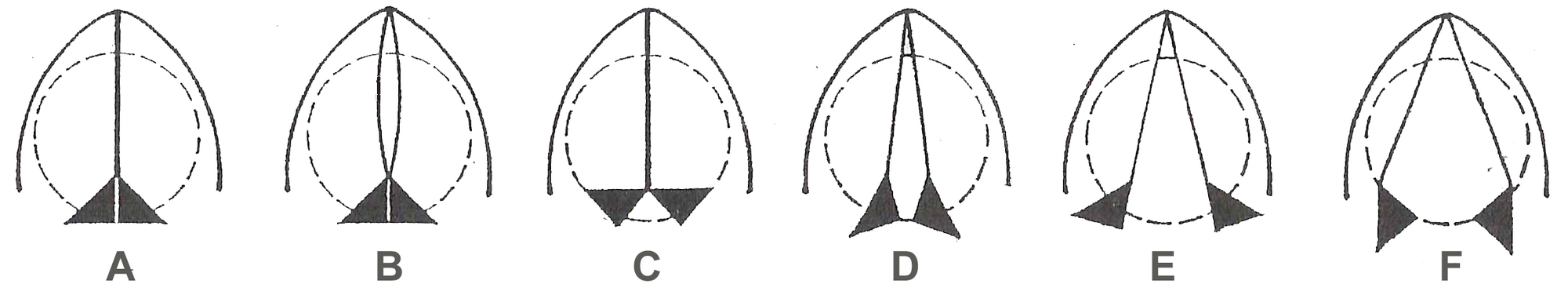Askew Position Of Glottis / Anatomo-Physiology of the Glottis and Neoglottic Region ... : All the crocodilia are possessed of a loud, bellowing voice.