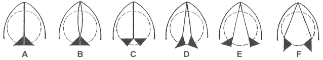 File:Glottis positions.png