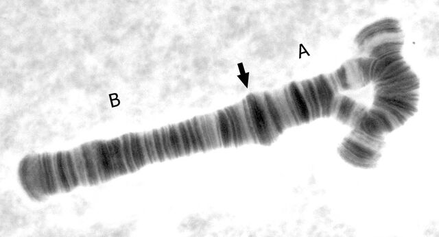 File:A arm inversion.jpg