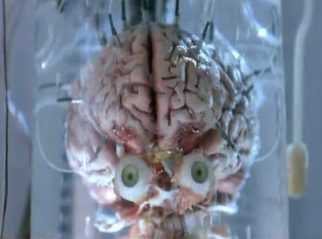 File:Cainsbrain.png