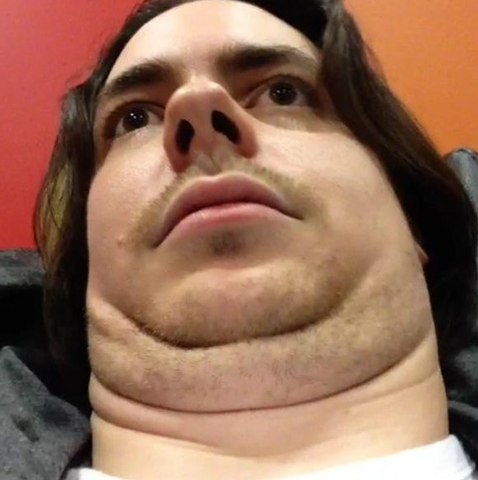 File:Egochin.png
