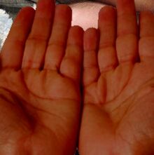Hands
