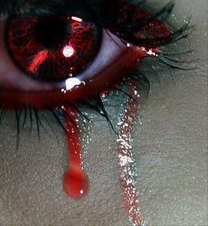 Blood in my eyes