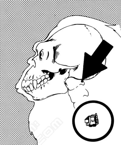 File:Tracer implant.jpg