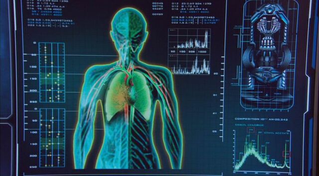 File:Bioexplosivedevice.jpg