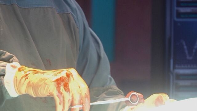 File:ExplosiveTumor.jpg