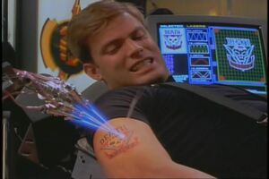 Máquina de Tatuajes a Láser.jpg