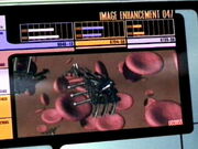 Nanoprobe