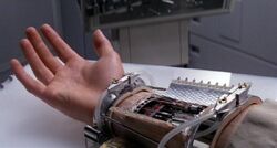 Prosthetic Replacement.jpg