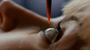 Miss Quill surgery