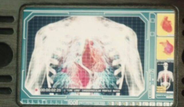File:Binary vascular system.jpg