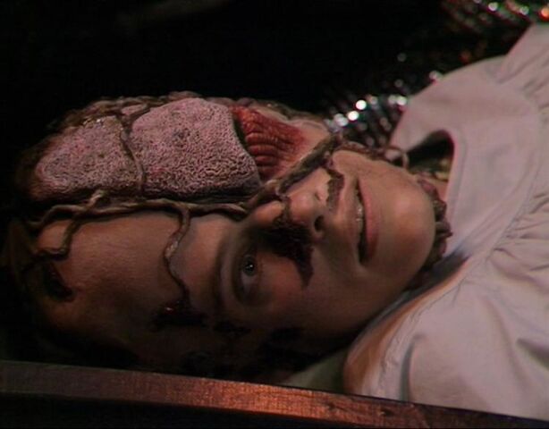 File:Human-Vervoid.jpg