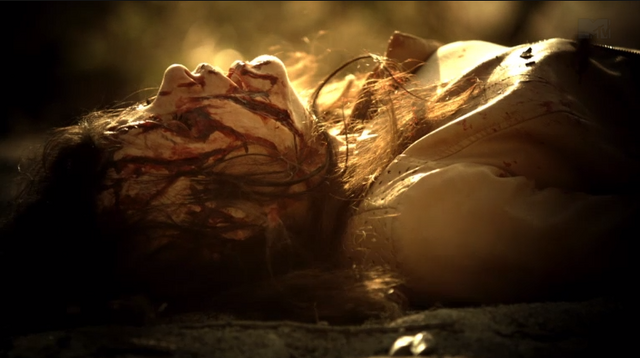 File:Teen Wolf Season 3 Episode 10 The Overlooked Jennifer clawed up by Kali.png