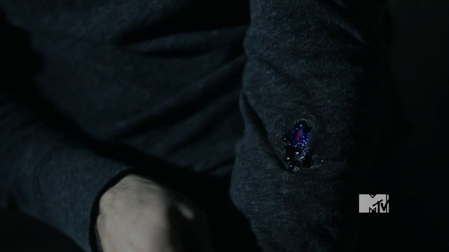 Archivo:Derek infected with wolfsbane bullet.png