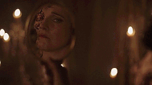 Countess disfigured face