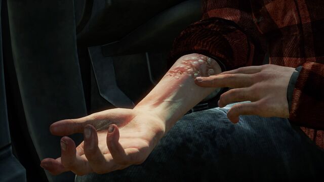 File:Ellies bite (spring).jpg