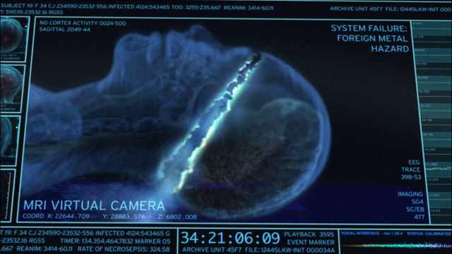 Datei:MRI 5.png