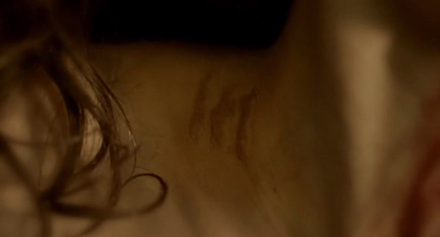 File:Wolfsangel burn.png
