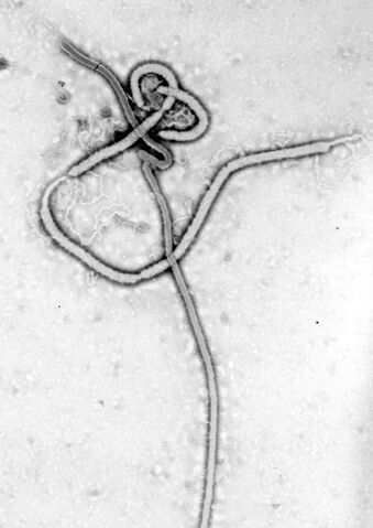 File:Ebola virus.jpg