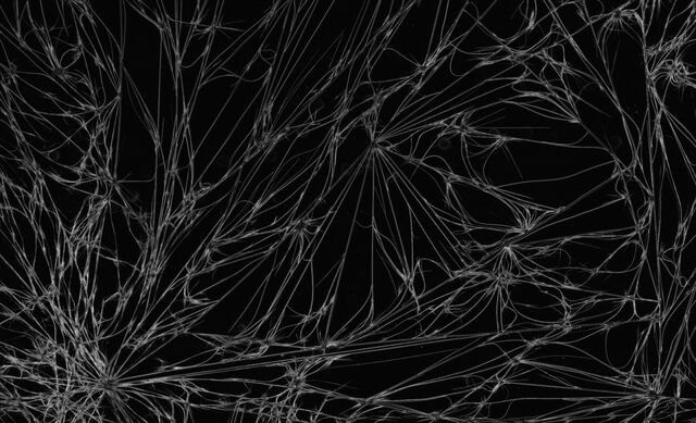 File:CaffeineCrystals Fibrous 10xDarkField-1-.jpg