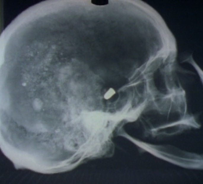 Skeleton box2 x-ray bullet