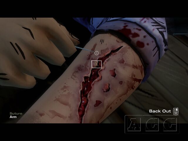 File:Clementine sewing her arm.jpeg