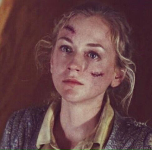 File:Season 5, Episode 8 - Beth Greene's last moments.jpg