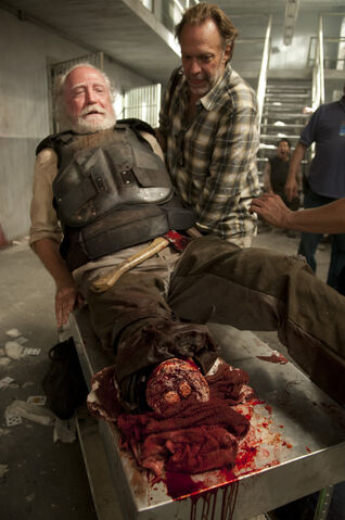 File:Hershel Leg.jpg