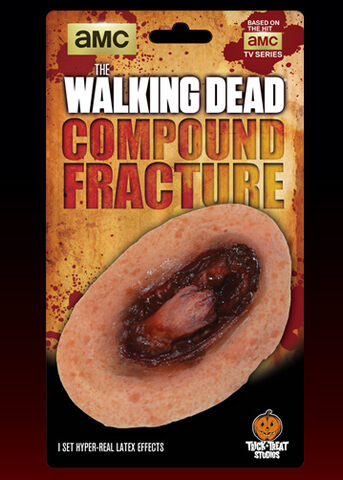 File:Walker Compound Fracture Appliance.jpg