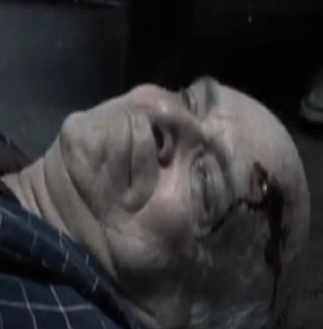 File:Elderly Male Patient.png