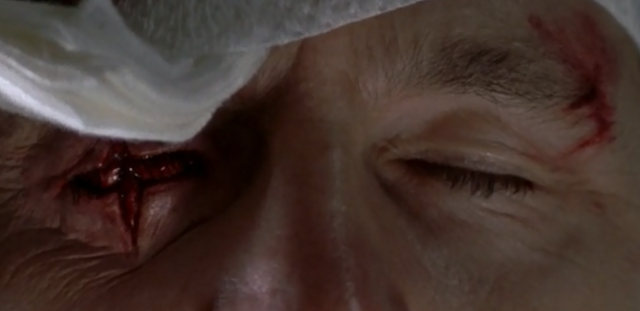 File:Governor Gouged Eye.png